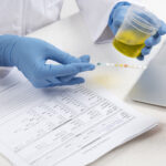 SNP How to reduce Creatinine level?